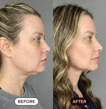Megan, 44