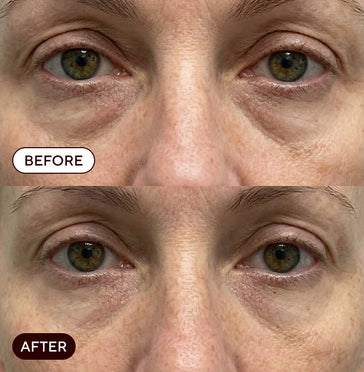 Rachel, 55